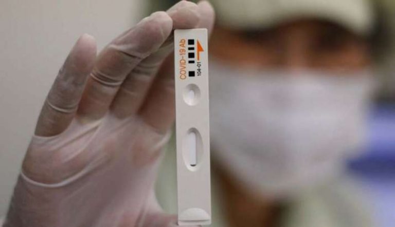 UP में बीते 24 घंटे में कोरोना के 170 नए मामले मिले, 6 जिलों में कोरोना की दस्तक से स्वास्थ्य महकमा सचेत