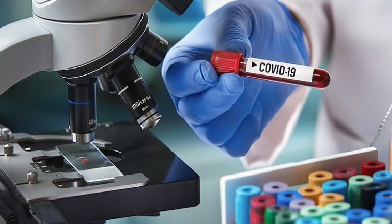 COVID-19 Bihar : RTPCR से कोरोना जांच में 2 प्रतिशत सैंपल ही आ रहे पॉजिटिव, बिहार में संक्रमितों की संख्या में गिरावट…