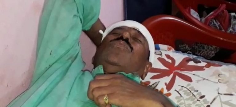 WB Election 2021 : अब ममता सरकार के मंत्री पर हमला, सिर में आयी चोट, उग्र समर्थकों ने किया प्रदर्शन