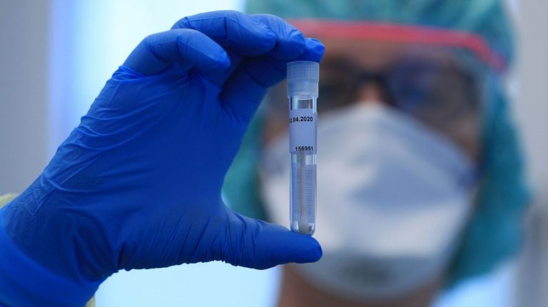 Rt pcr test cost in jharkhand : 
दिल्ली में 800 रुपये में आरटीपीसीआर जांच, झारखंड में लग रहे हैं “1050