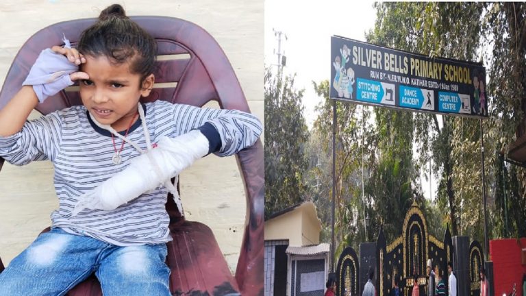 बिहार: कटिहार के स्कूल में मासूम की उंगली कटी, शिक्षिका ने आनन-फानन में डस्टबिन में फेंक दिया, फिर…