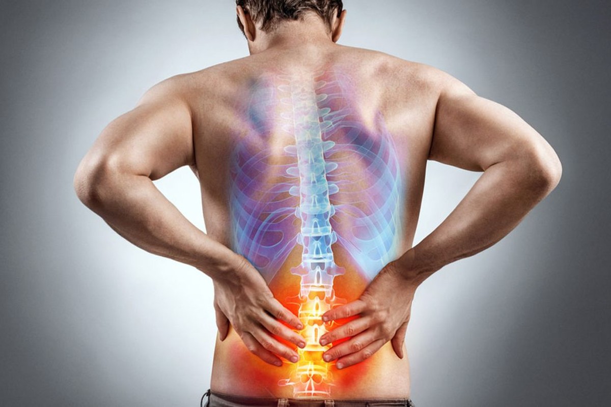 Back pain