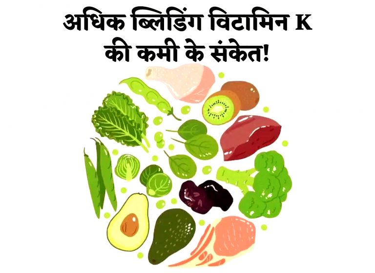 Vitamin K: ‘विटामिन के’ की कमी से हो सकते हैं कई रोग, अधिक ब्लीडिंग हो सकती है ‘विटामिन K’ की कमी के संकेत