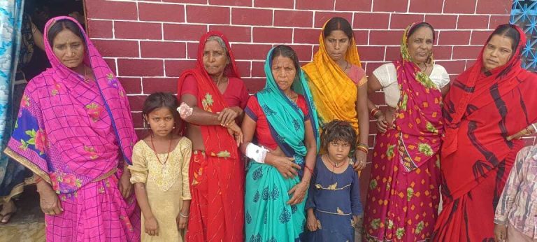 एक दर्जन लोगों को बंदर ने काटा , आतंक से ग्रामीण सहमे