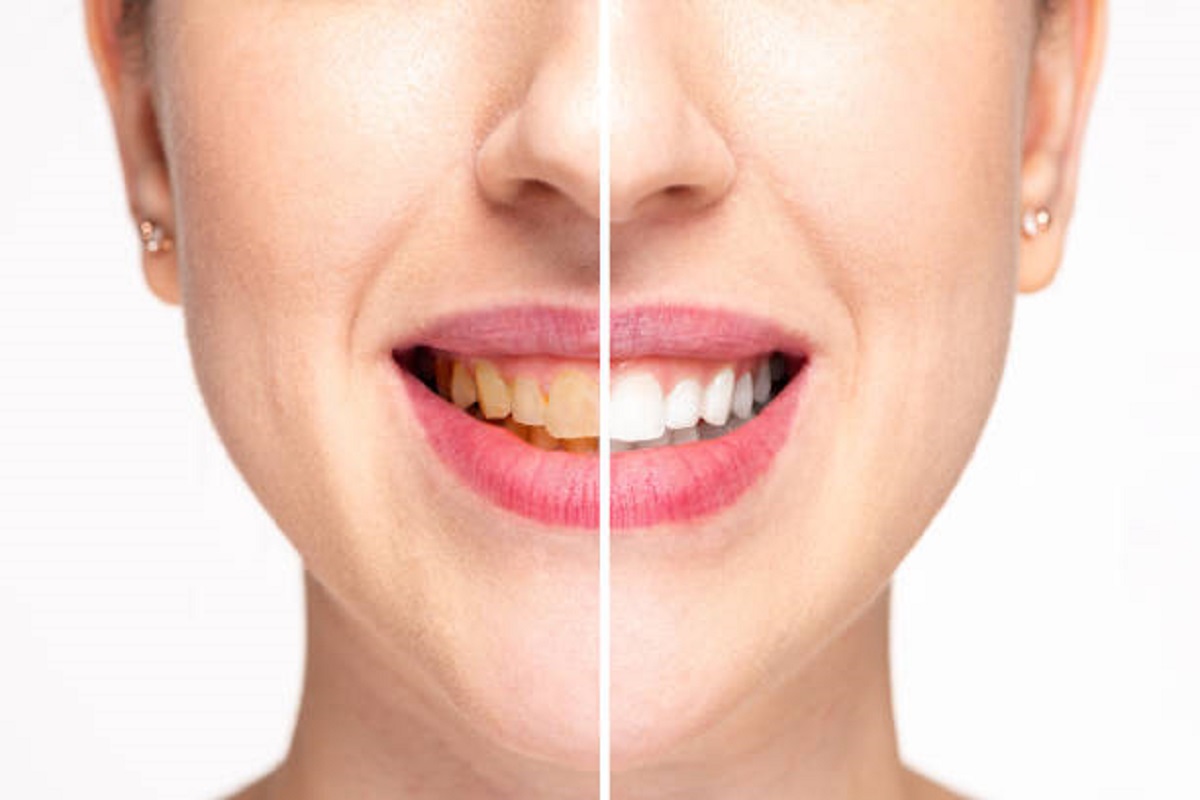 Tooth remedies