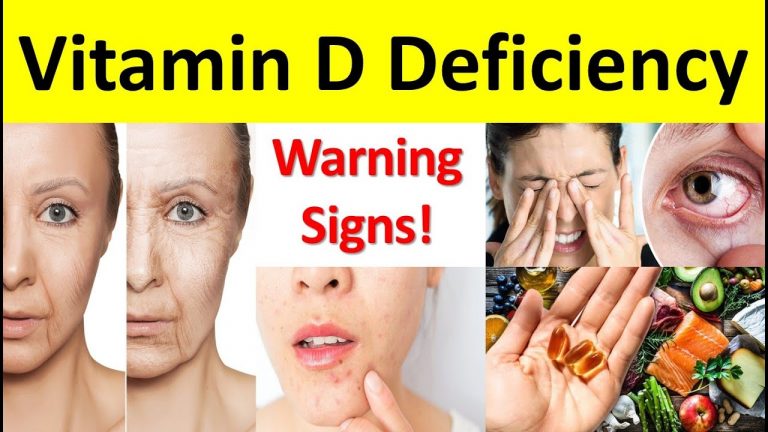 Vitamin D Deficiency: शरीर में विटामिन डी की कमी के हैं ये लक्षण, जरूर दें ध्यान