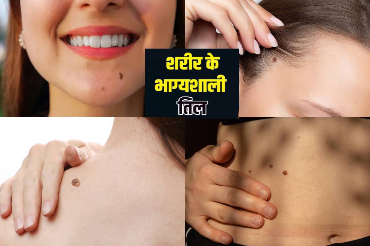 Lucky Moles On Female Body