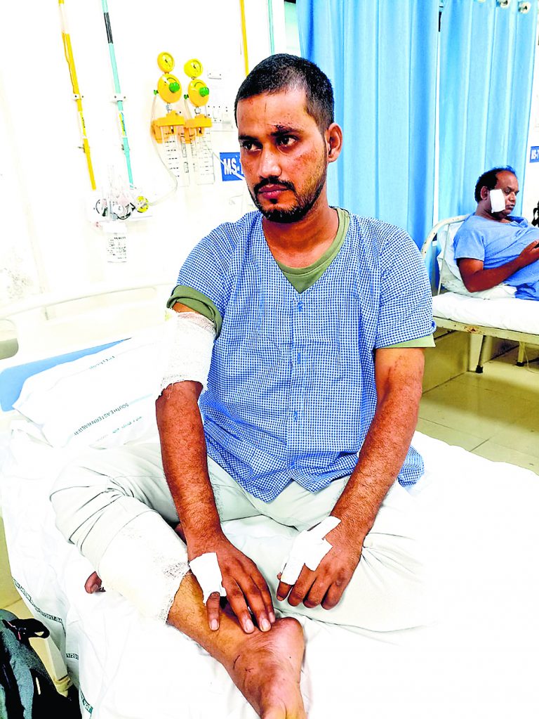 घंटों बाथरूम में बेहोश पड़े रहे साहेब, किस्मत से बची जान