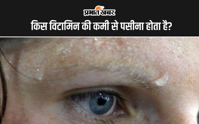 Vitamin Deficiency: किस विटामिन की कमी से पसीना होता है?