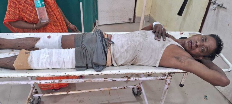 वाहनों की टक्कर में टैंकर चालक घायल, सदर अस्पताल ने किया रेफर
