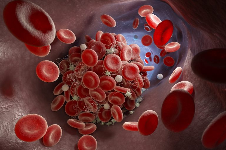 Platelet Count :  डेंगू के अलावा शरीर में प्लेटलेट काउंट कम होने के कारण?