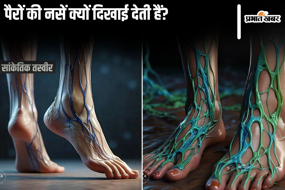Visible Leg Veins