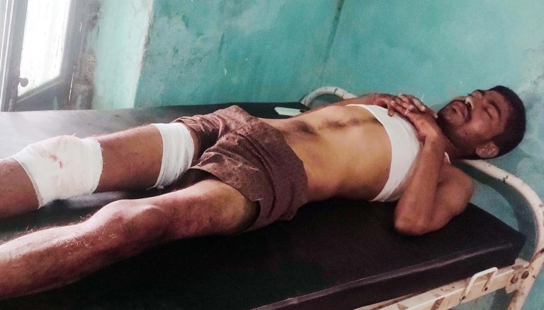 ऑटो पलटने से तीन व्यक्ति जख्मी, अन्य की स्थिति नाजुक, रेफर