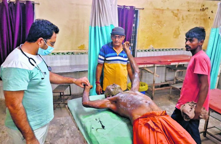 Gopalganj News : दरवाजे पर सो रहे बुजुर्ग किसान पर तेजाब से हमला, पीएमसीएच रेफर