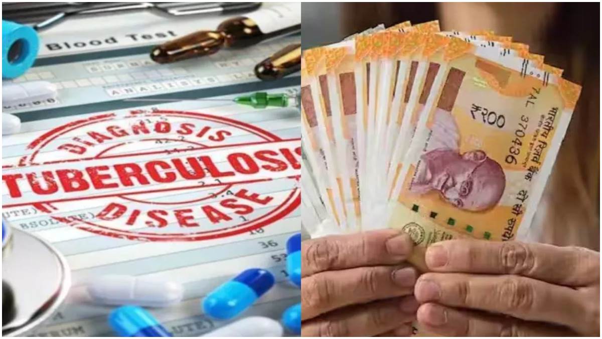 tb patients news| Good News: TB patients in Bihar will now get Rs 100 every month