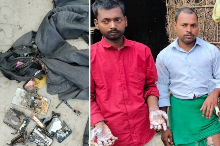 Bihar News: अचानक पैंट में फटा मोबाइल, लगी आग, बचाने में झुलसे परिजन