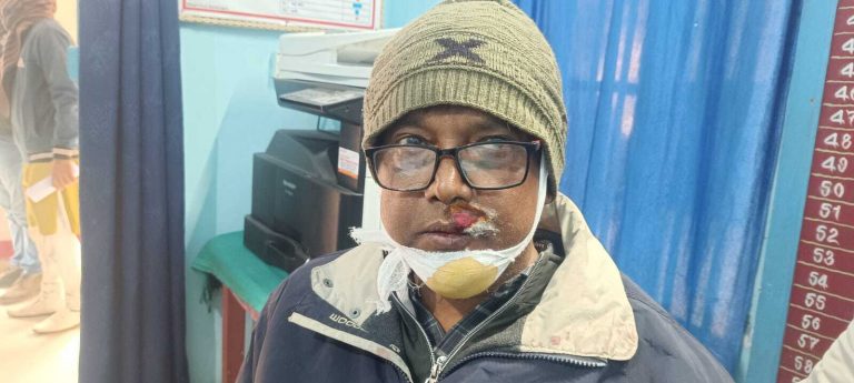 राजस्व कर्मचारी ने मारपीट का लगाया आरोप, पिता-पुत्र गिरफ्तार