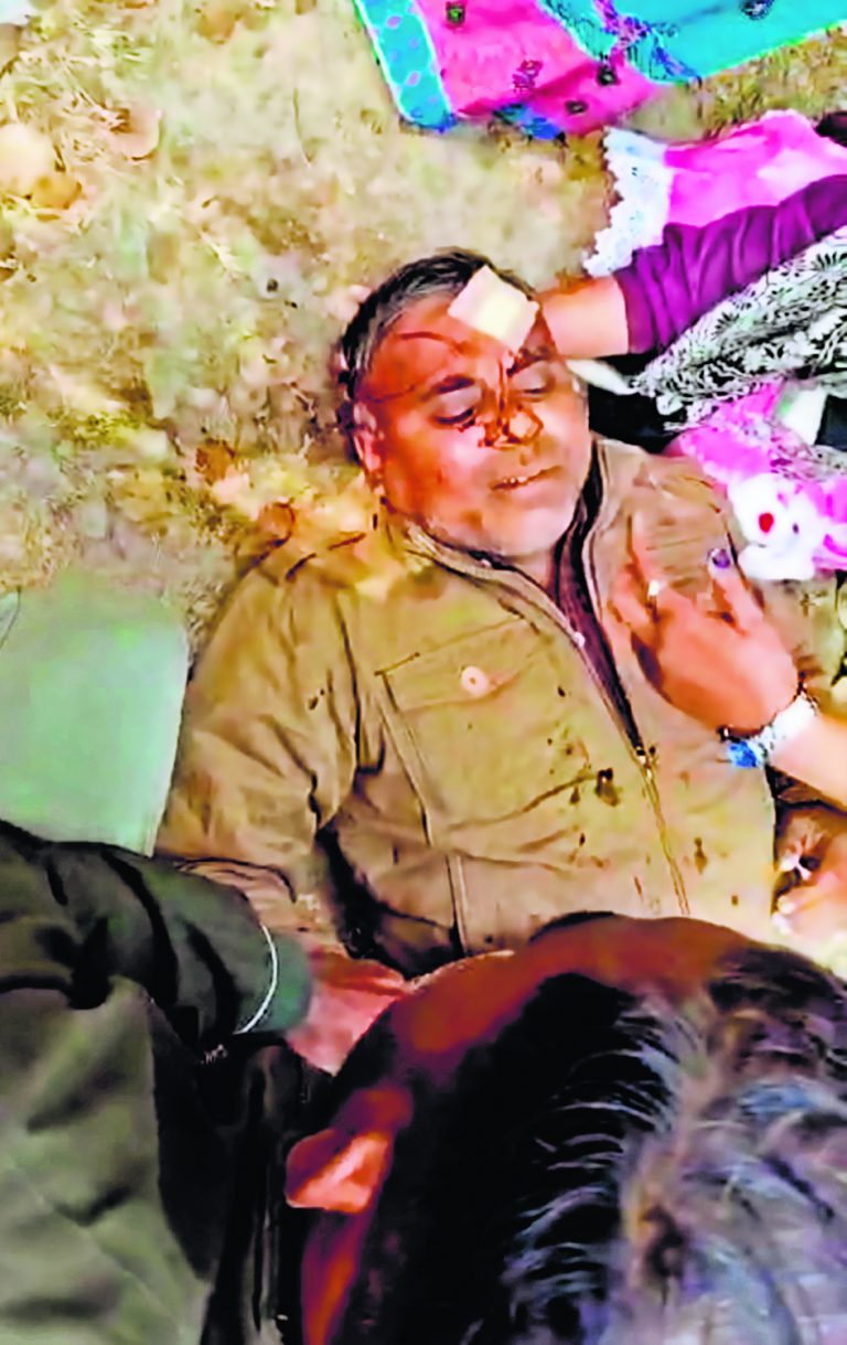 Gaya News : रील बनाने से रोका, तो छात्र ने अपनी मां के साथ मिल कर शिक्षक का सिर फोड़ा