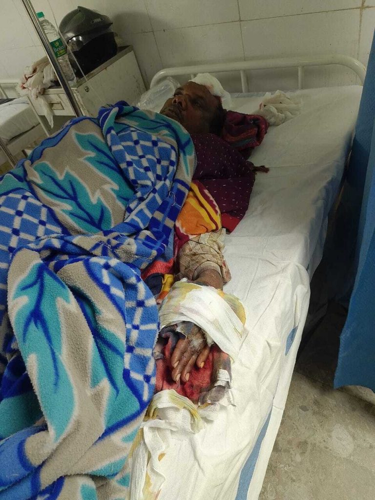 घर के बरामदे पर सोये अवस्था में धारदार हथियार से किया हमला, रेफर