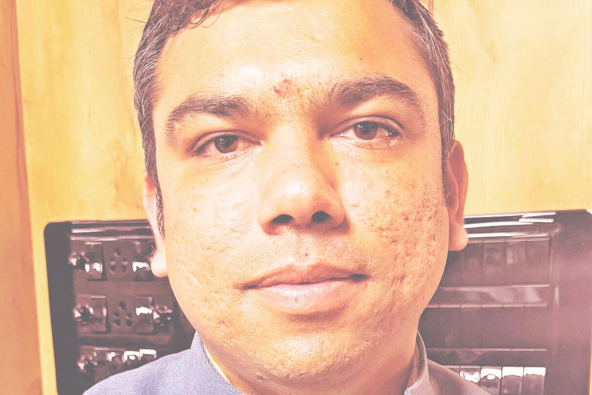 Dr Montu Kumar M Patel