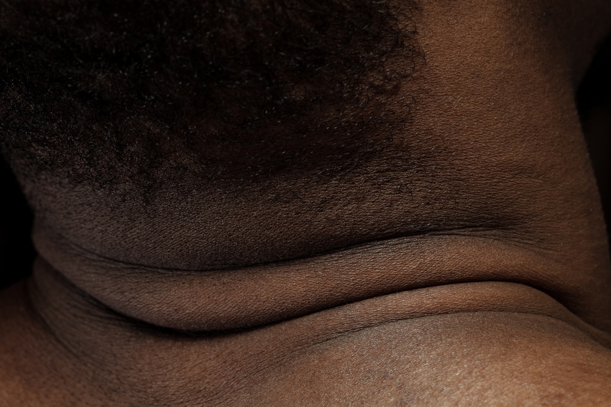 dark neck