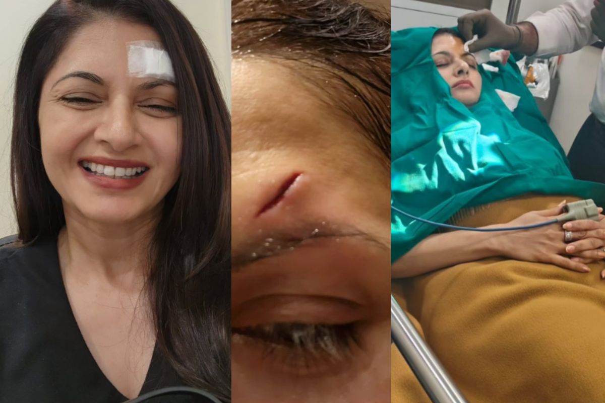 Bhagyashree gets injured