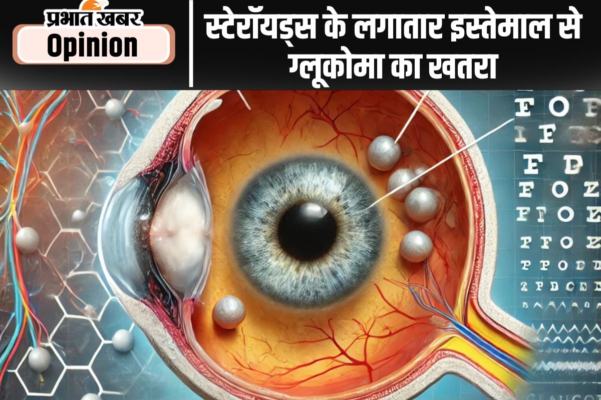 Glaucoma due to continuous use of steroids