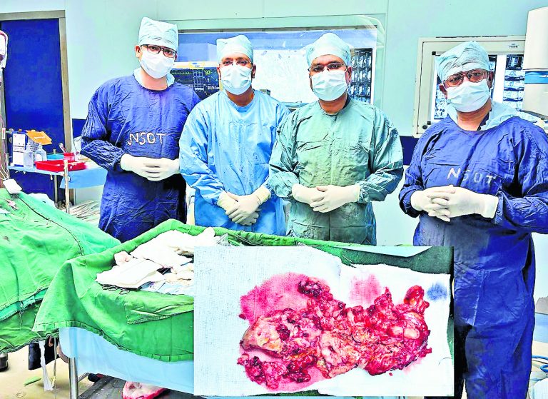 Ranchi News : मरीज की रीढ़ से एक किलो का ट्यूमर निकाला