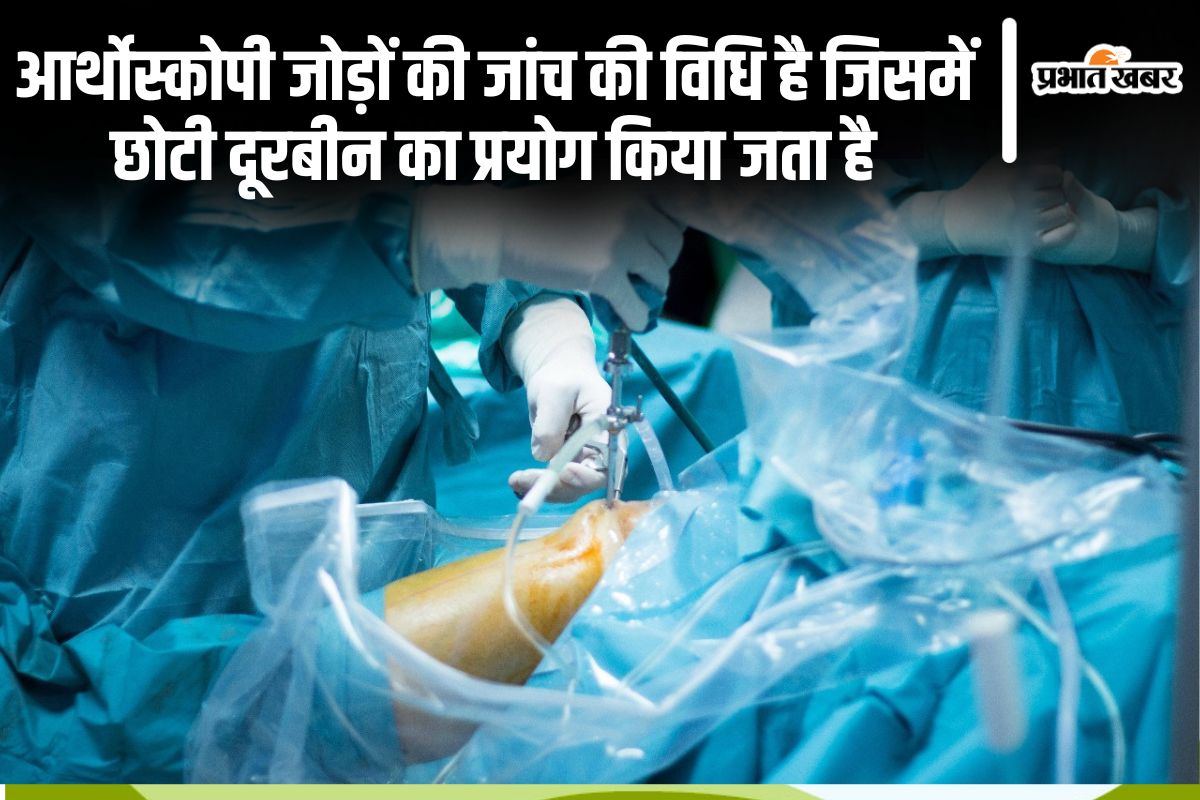 Arthroscopy
