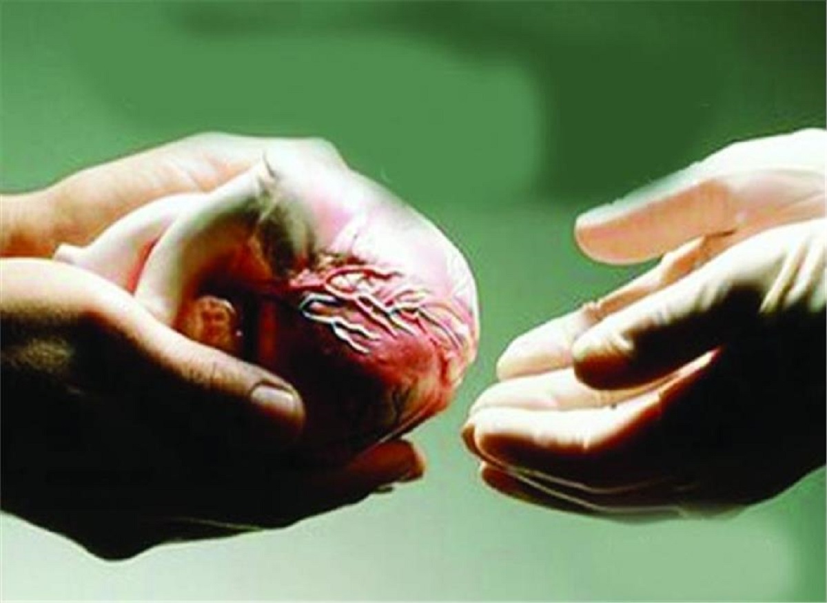 Organ Donation