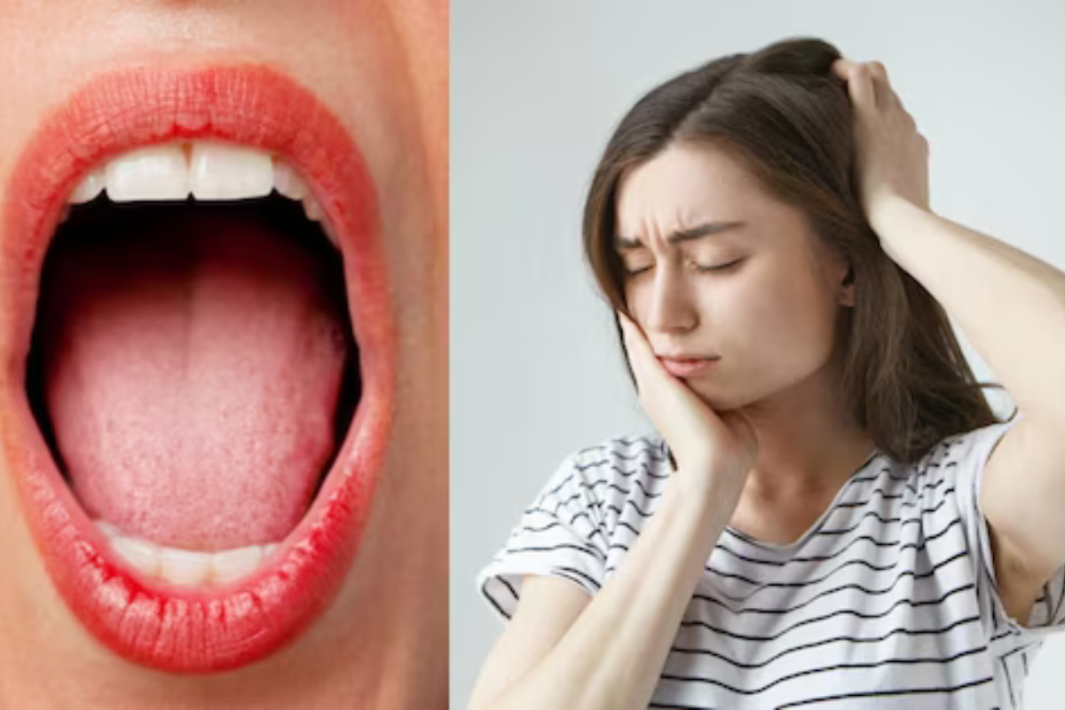 Dry Mouth