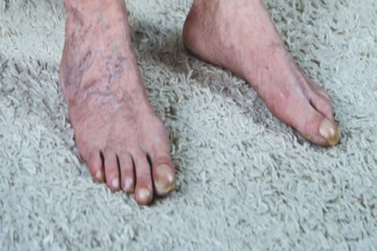 feet
