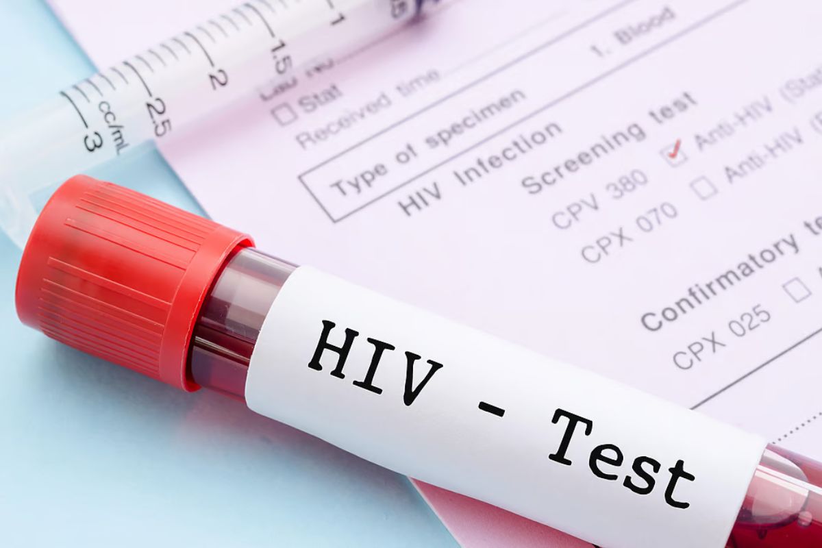 HIV Positive
