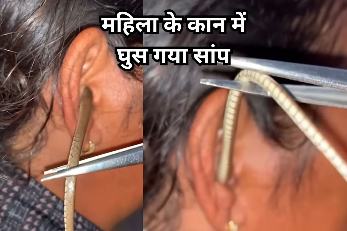 Snake enters woman's ear