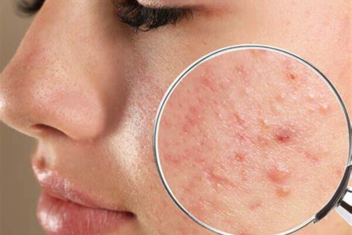 Skincare Tips