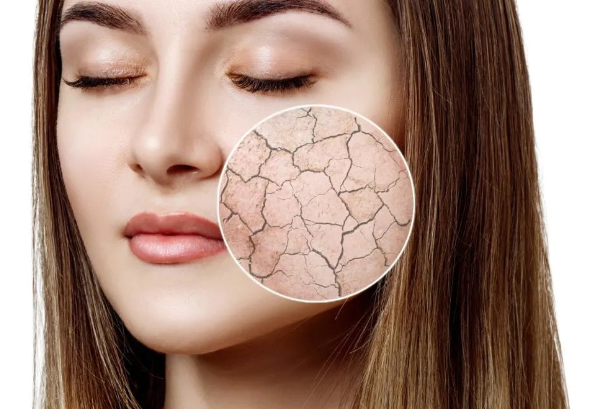 Dry Skin Home Remedies