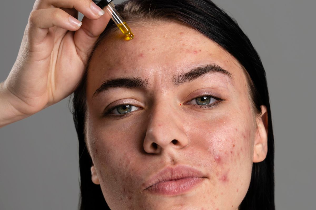 Skincare Tips