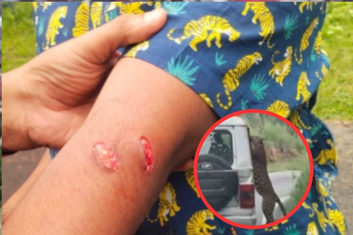Leopard Attacks on boy