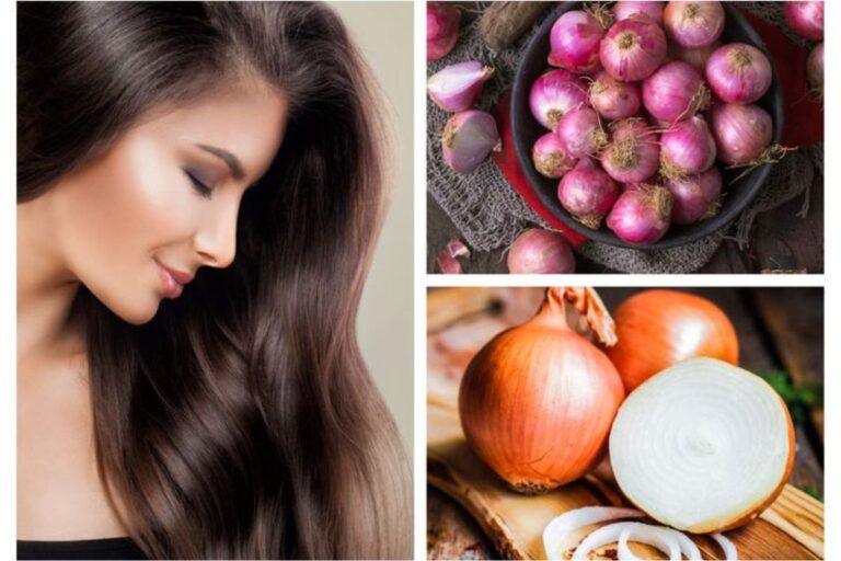 Onion For Hair Fall: अगर आप भी झड़ते बालों से हैं परेशान तो ट्राय करें प्याज का मैजिक ट्रिक्स