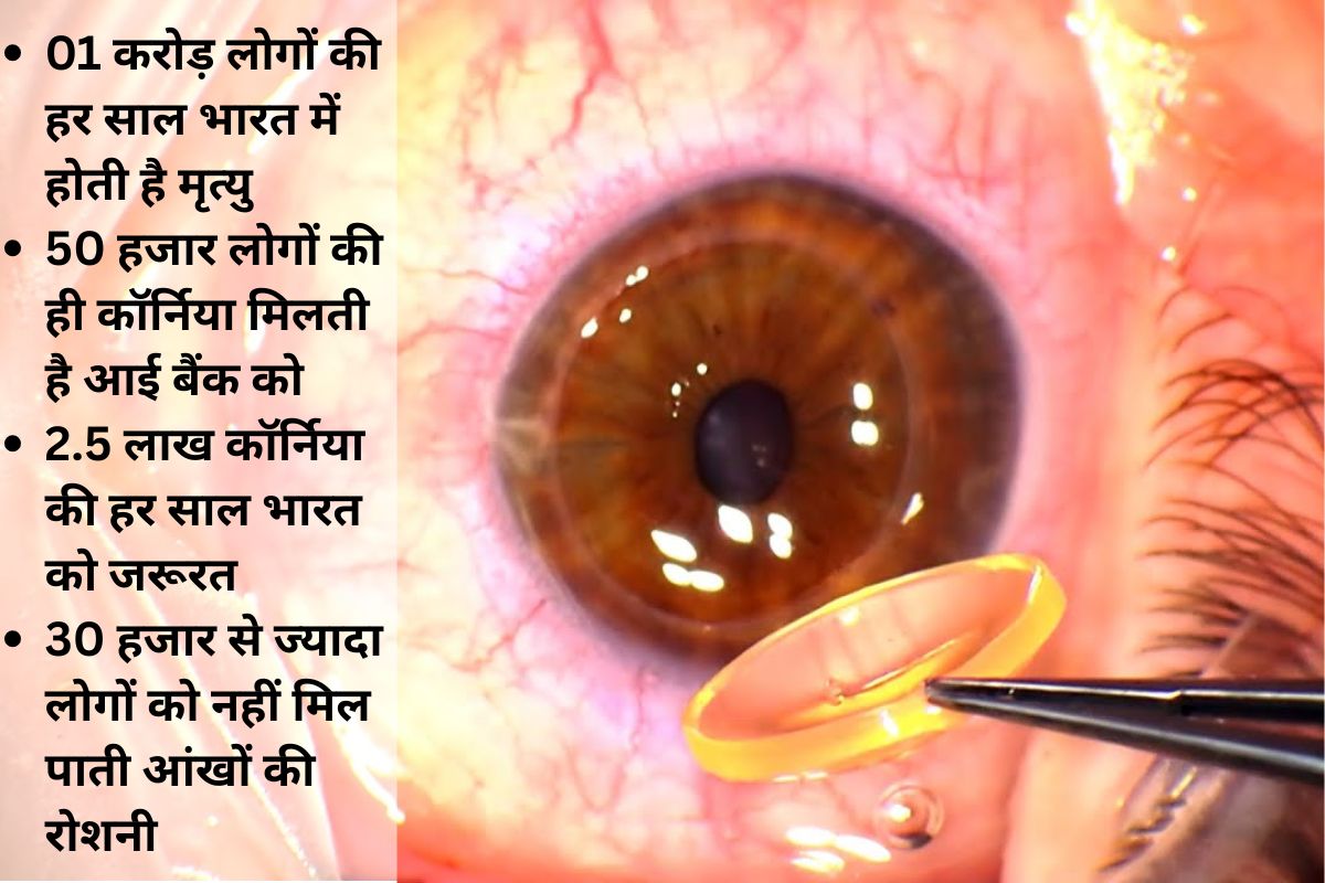 Run For Vision In Ranchi Jharkhand Today News 1