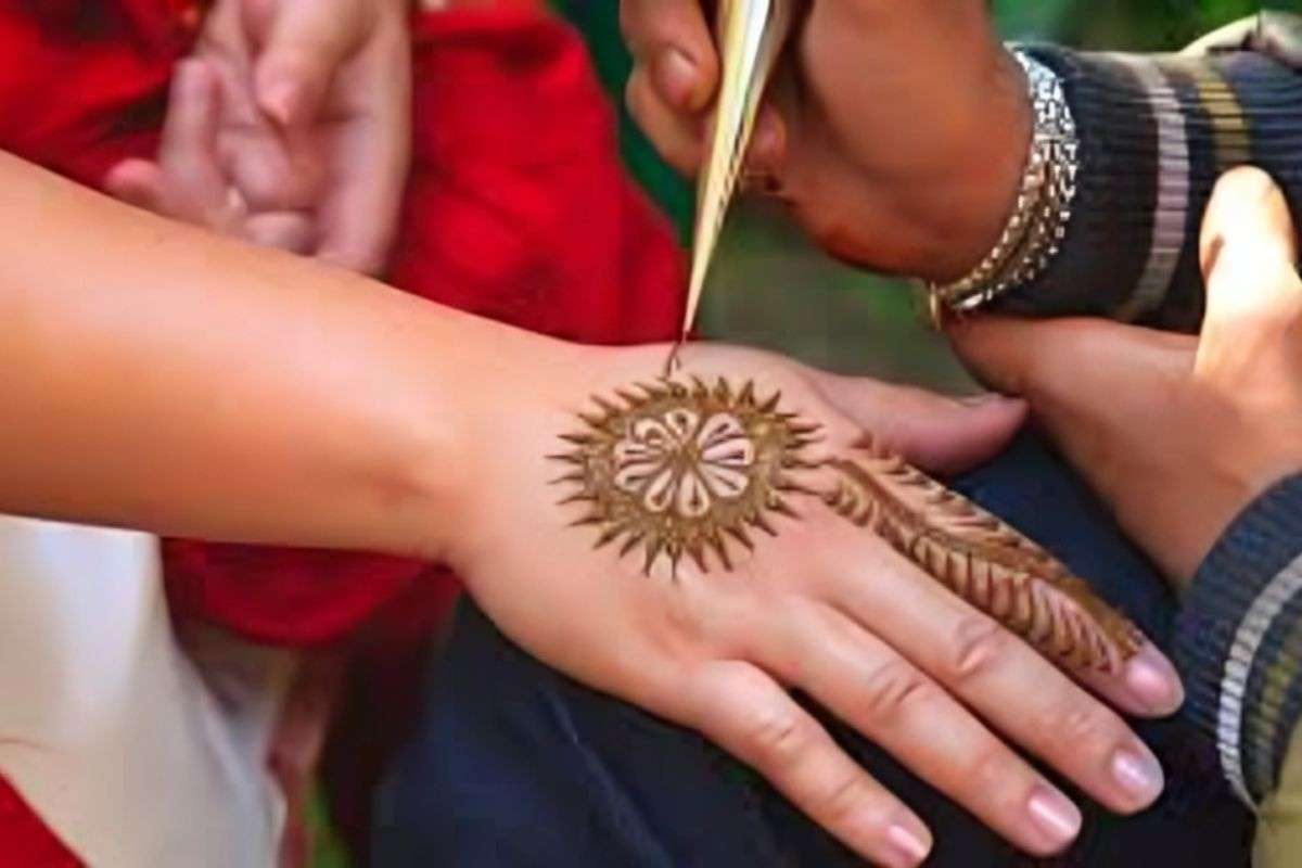 Mehndi burns the entire body, chemical mehndi poses a threat