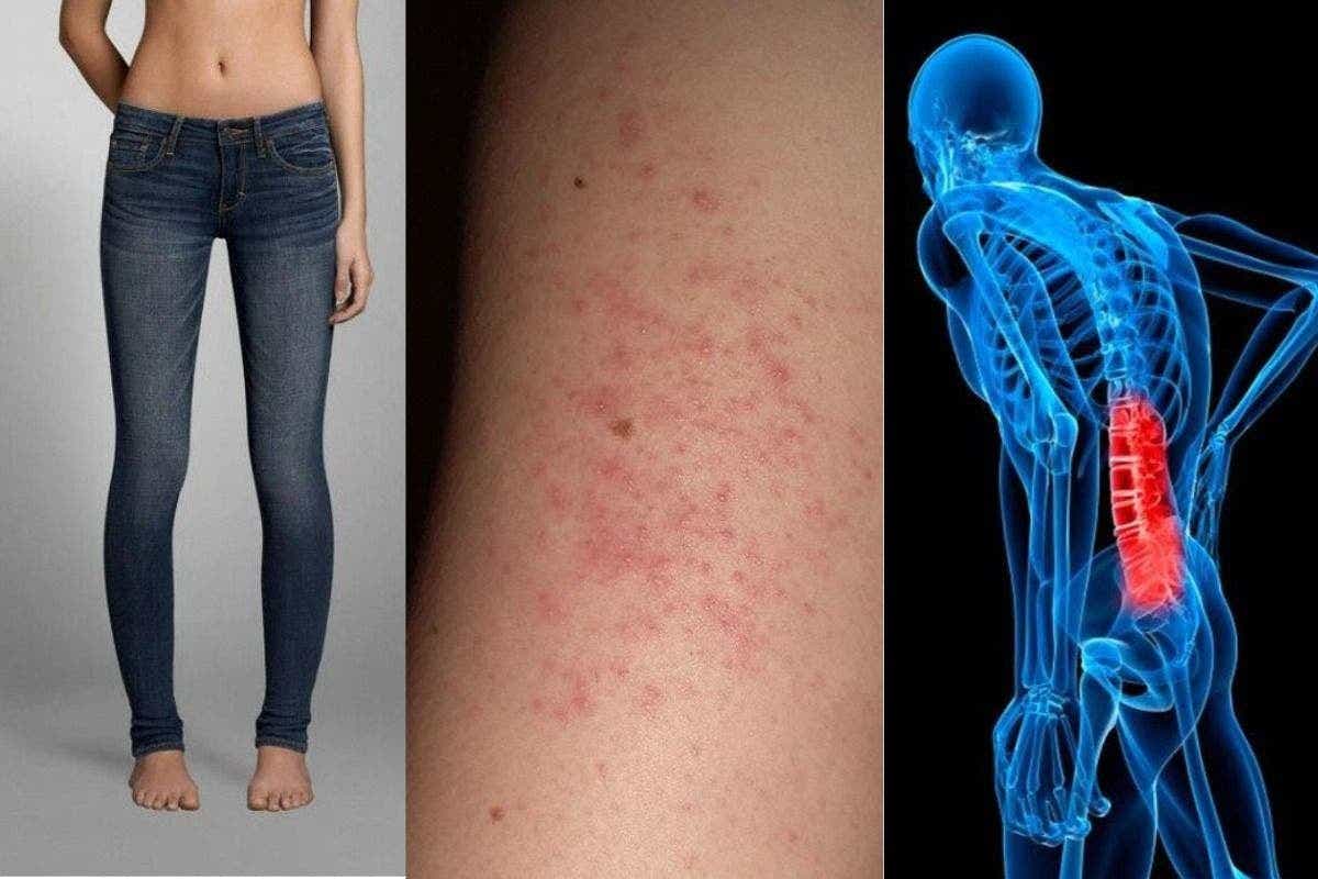 Tight Jeans Side Effects