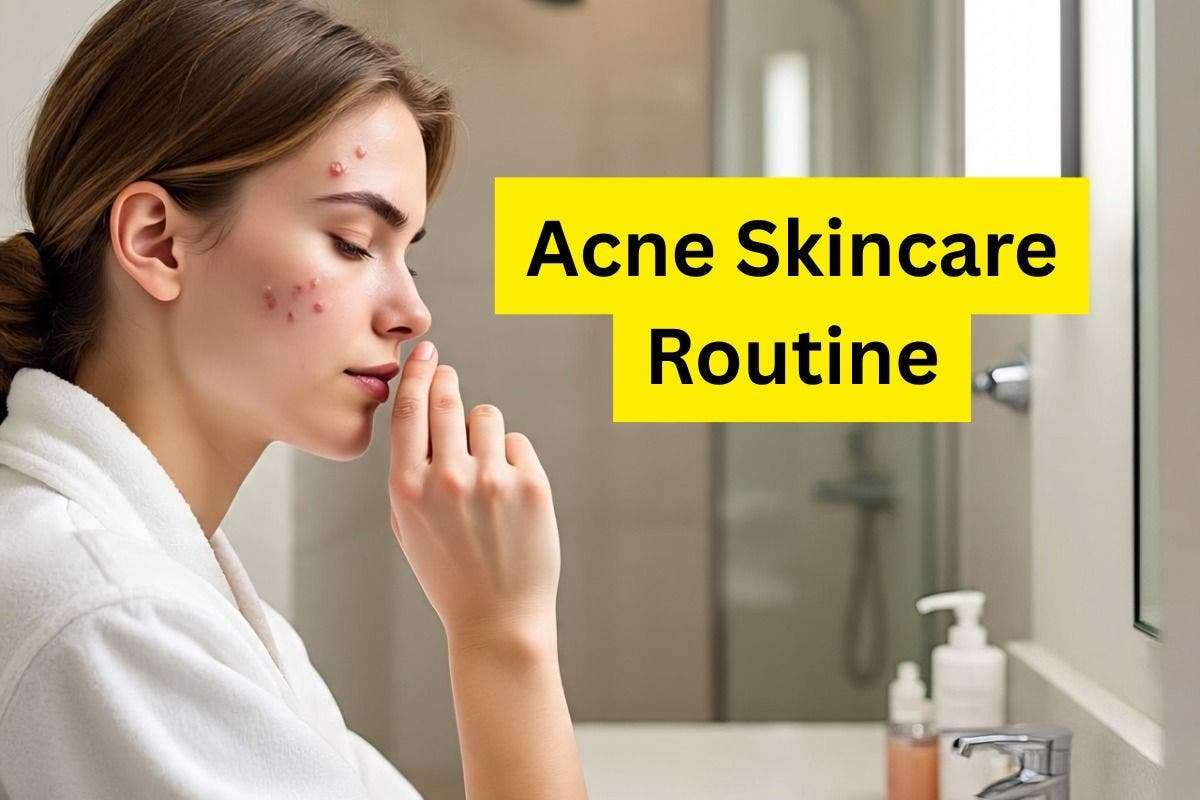 Acne Skincare Routine
