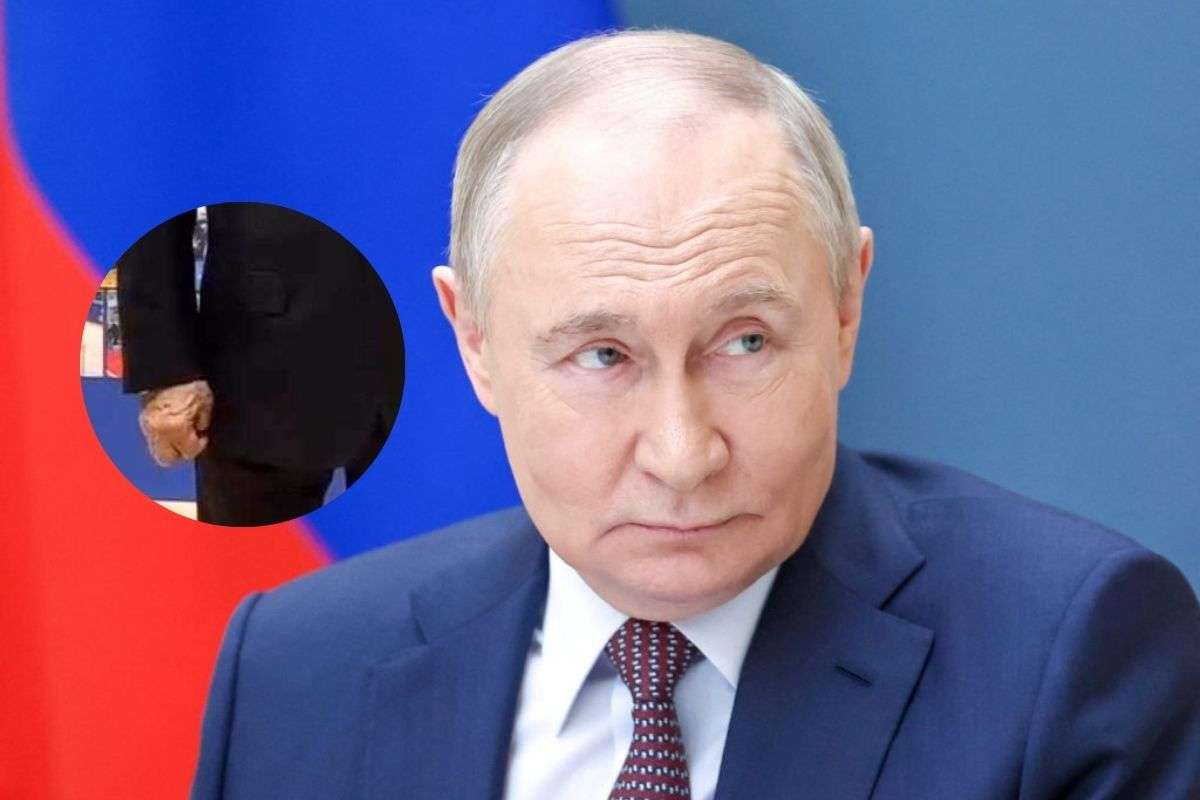 Putin Swollen Right Hand veins video health