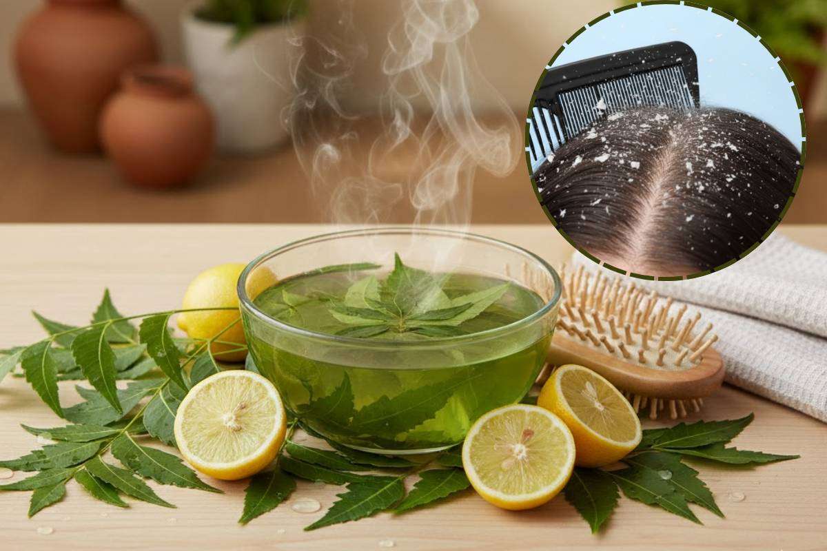 Natural Hair Care Tips: नीम और नींबू के पत्तों का पानी दूर करेगा डैंड्रफ और झड़ते बालों की समस्या - ट्राइ करें नेचुरल हेयर क्लीन्सर