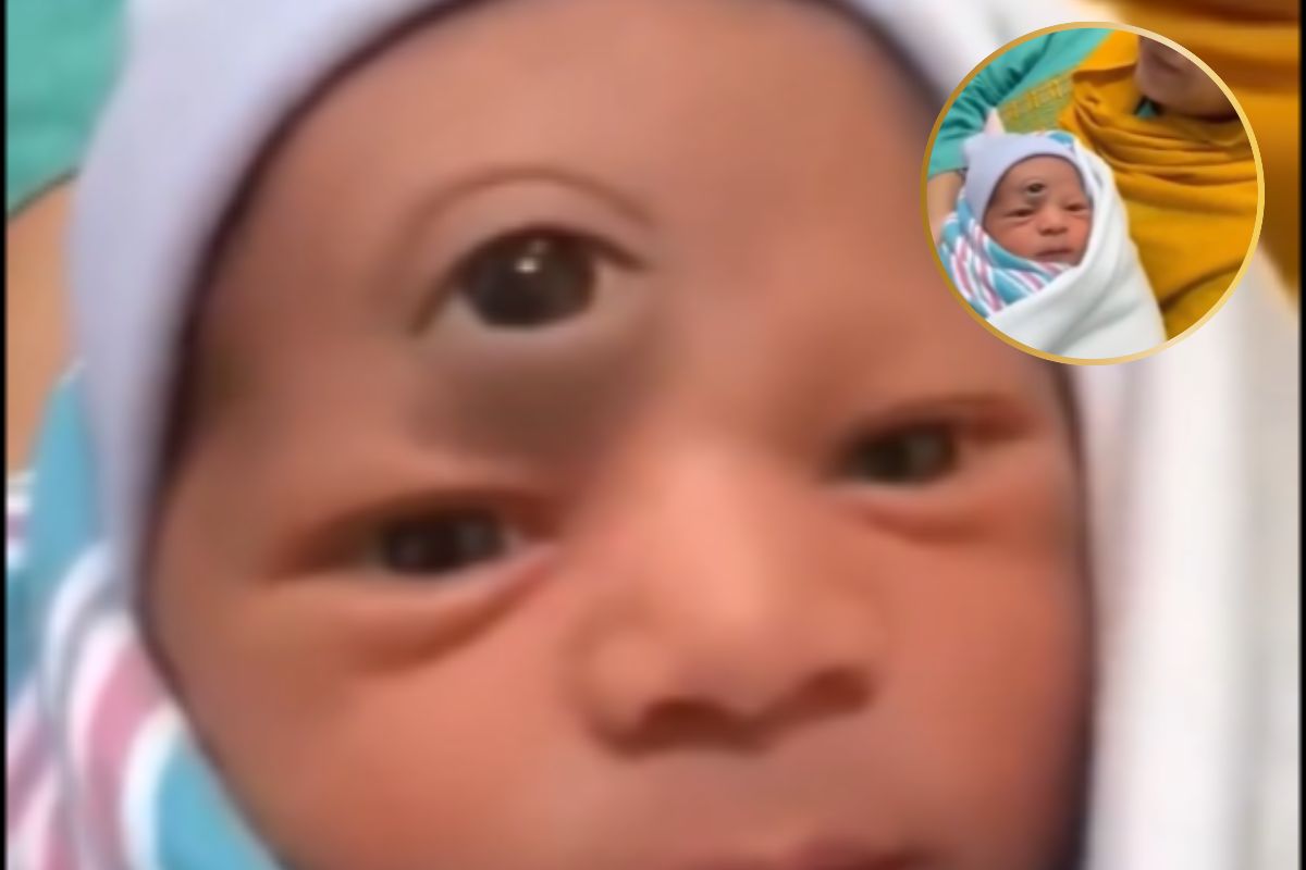 Child with Three Eyes Fact Check