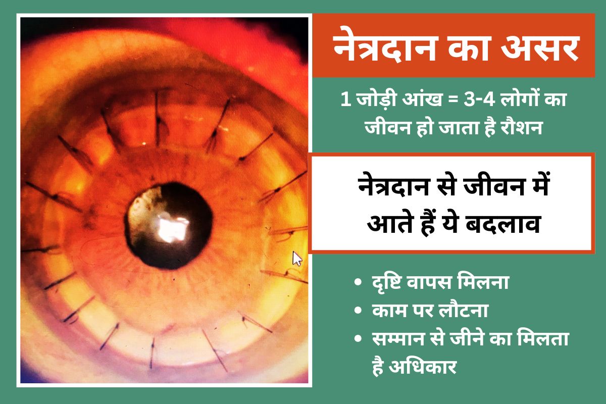 Eye Donation News Kashyap Memorial Eye Bank Ranchi Jharkhand News