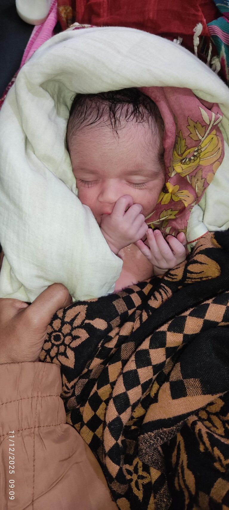 कोसी में आईवीएफ से पहली जुड़वां संतान जन्मी