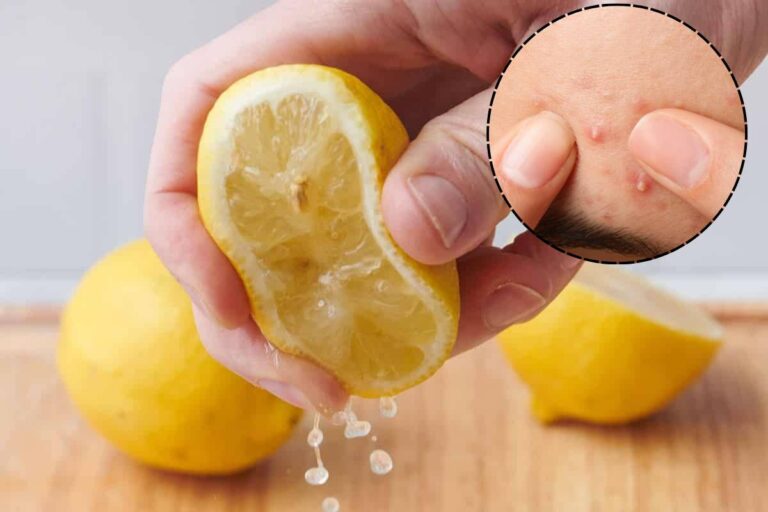 Lemon Juice Side Effects: चेहरे की रंगत छीन सकता है नींबू का रस, ये लोग बिल्कुल न करें इस्तेमाल