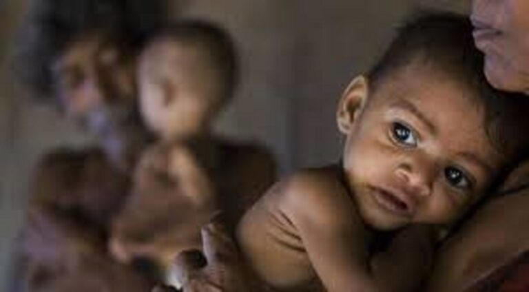 Malnutrition: कुपोषण से निपटने के लिए राष्ट्रीय स्तर पर भागीदारी जरूरी